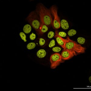 Widefield imaging